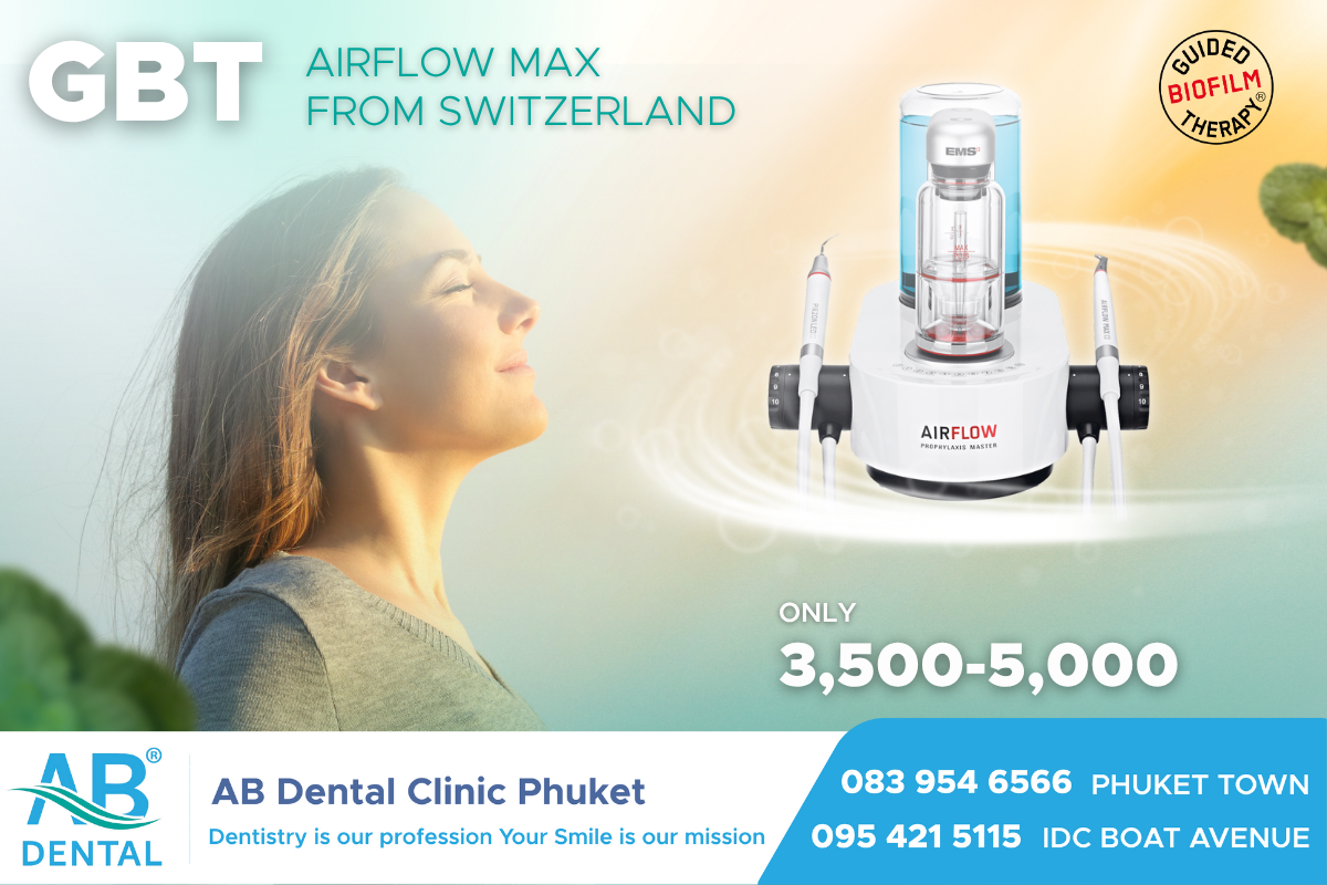 airflow powder,airflow plus powder,ไบโอฟิล์ม,airflow,ทำความสะอาดฟัน,Prophylaxis Master,dental phuket,ab dental phuket,ab dental, gbt, gbt phuket, เหงือสุขภาพดี