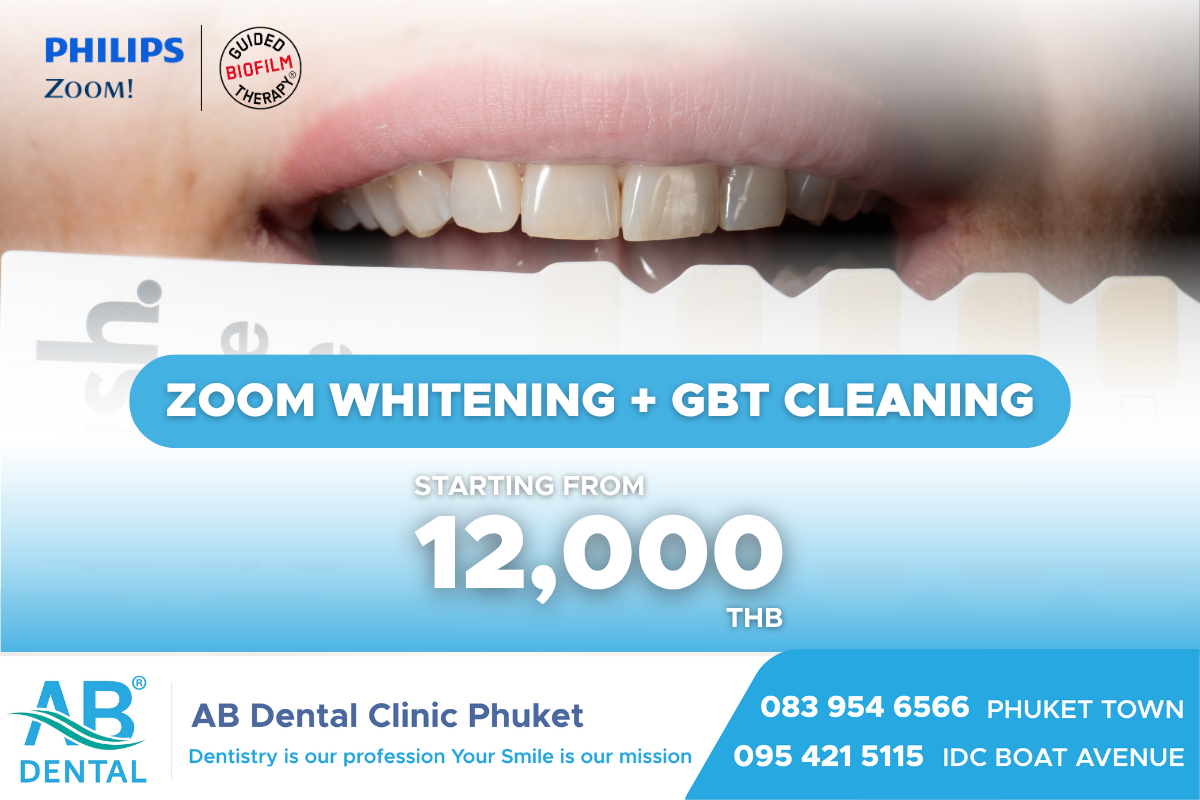 airflow powder,airflow plus powder,ไบโอฟิล์ม,airflow,ทำความสะอาดฟัน,Prophylaxis Master,dental phuket,ab dental phuket,ab dental, gbt, gbt phuket, เหงือสุขภาพดี, Whitening, GBT, AB Dental Phuket