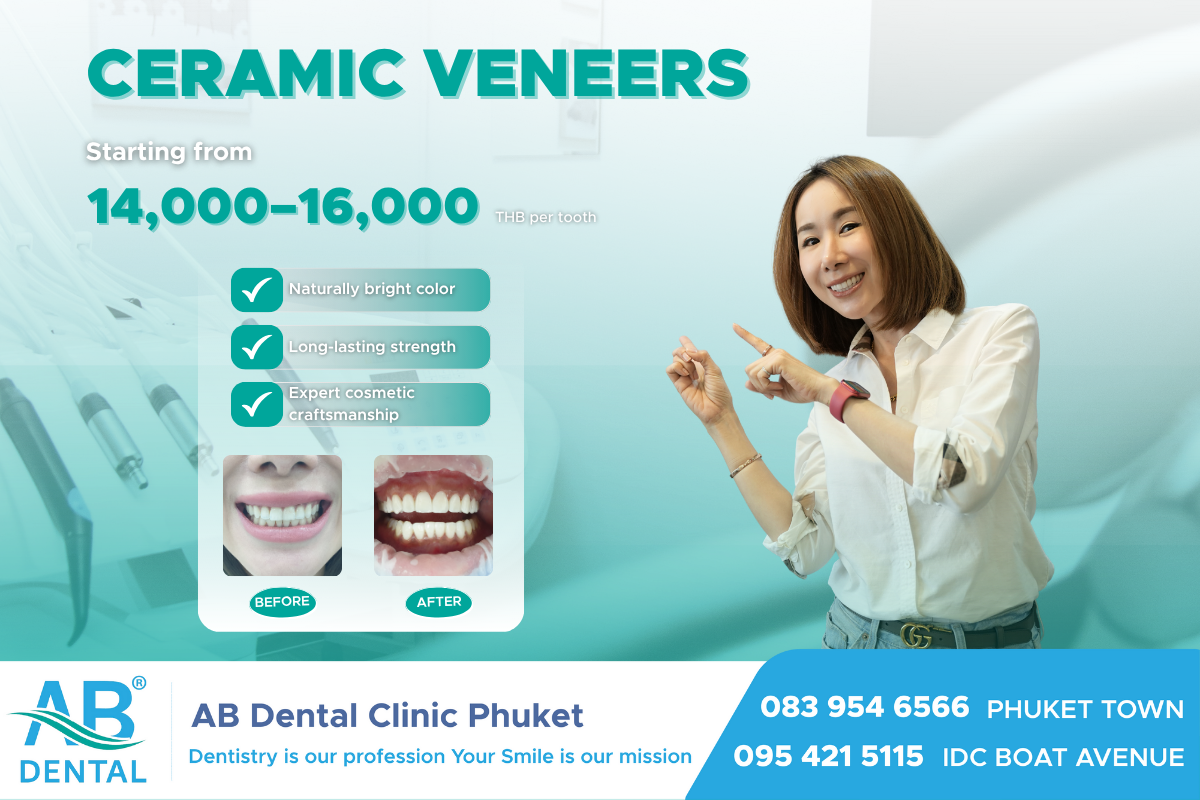 dental veneer, veneer dental, at home dental veneer kit, china dental outsourcing dental veneer, dental veneer cost, dental veneer Patong, dental veneer Thailand, dental veneer design, what is veneer dental, dental veneer perth, veneer dental cost, dental veneer clearwater, fridley dental veneer, dental veneer adhesive, blaine dental veneer, dental veneer prices, dental veneer meaning, veneer dental services, dental veneer dentists gatl