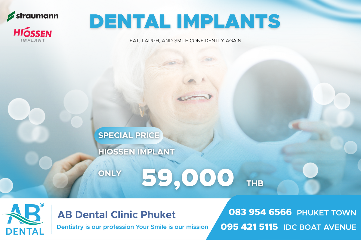 รากฟันเทียม, รากฟันเทียมภูเก็ต, AB Dental Phuket, AB Dental, AB Dental Clinic Phuket, การทำทันตกรรม รากฟันเทียม (Dental Implant), รากฟันเทียม, รากฟัน, ฟันปลอม, ฝังรากฟัน, ครอบฟัน, ทดแทนฟัน, ฝังรากฟันเทียม, รากฟันเทียมดียังไง, ทำรากฟันเทียมที่ไหนดี, Dental Implant, Dental Implant Phuket, Dental Phuket
