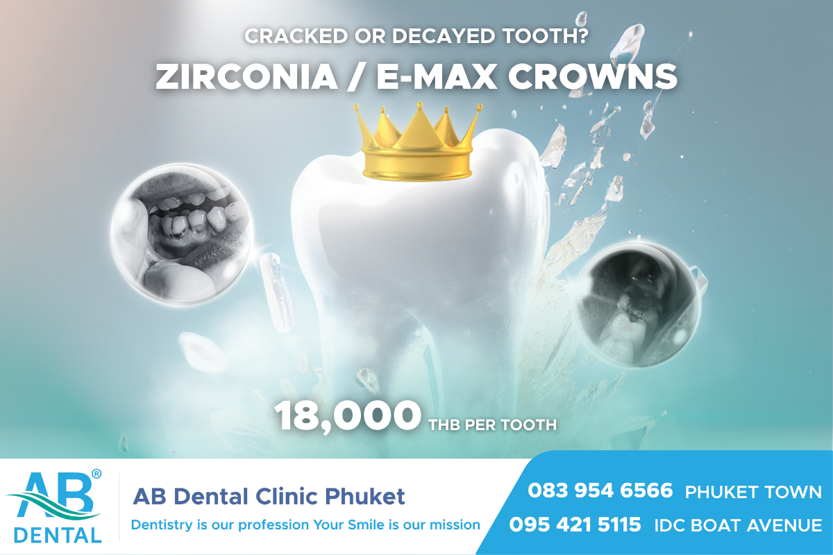 one day crown,deantal crown,deantal crown phuket,one day crown phuket,dental phuket,ab dental phuket,ab dental,ad dental studio, Zirconia / E-max, Zirconia, E-max, ฟันแตก, ฟันผุเยอะ, ฟันเปราะ
