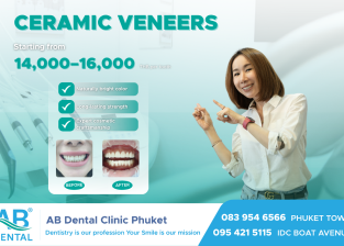 รอยยิ้มที่เปลี่ยนภาพลักษณ์ใน1วัน ขอแนะนำ Ceramic Veneer วีเนียร์เกรดพรีเมียมจากแลปมาตรฐานสากล