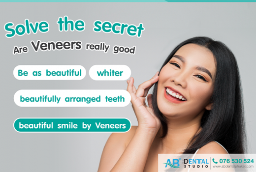 Solve the secret! Are Veneers really good?? Be as beautiful as possible, whiter, beautifully arranged teeth, beautiful smile by Veneers.
