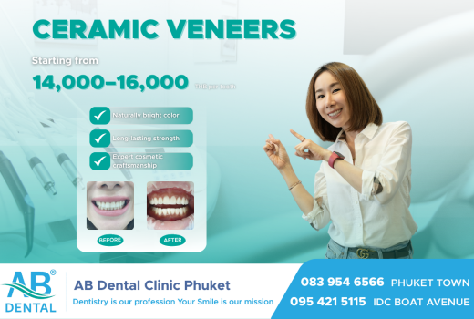 รอยยิ้มที่เปลี่ยนภาพลักษณ์ใน1วัน ขอแนะนำ Ceramic Veneer วีเนียร์เกรดพรีเมียมจากแลปมาตรฐานสากล