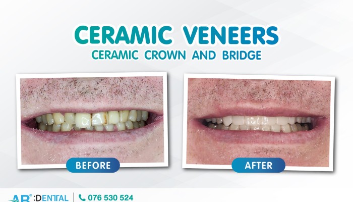 คลินิกทันตกรรม,คลินิกจัดฟัน, คลินิก จัด ฟัน ภูเก็ต, คลินิกทำฟัน ภูเก็ต, dental clinic, dental clinic phuket, phuket dental clinic, dental clinic near me