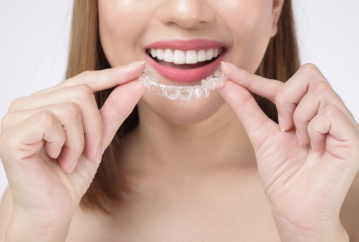 Invisalign clear braces, fast arrangement, easy to remove, no need to pay a lot