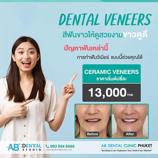 คลินิกทันตกรรม,คลินิกจัดฟัน, คลินิก จัด ฟัน ภูเก็ต, คลินิกทำฟัน ภูเก็ต, dental clinic, dental clinic phuket, phuket dental clinic, dental clinic near me, จัด ฟัน invisalign, dental veneer, ทําฟันปลอมที่ไหนดี, filling teeth, invisalign, crowns dental, ฟันปลอม, ฟอกสีฟัน, ฟอกฟันขาว, teeth whitening, รักษารากฟัน