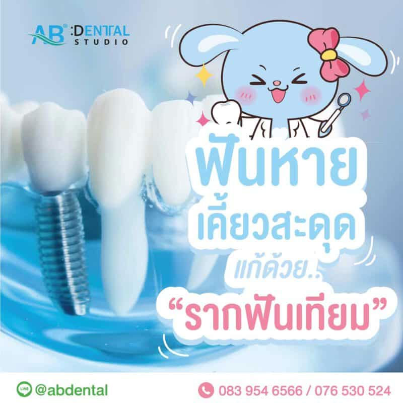 คลินิกทันตกรรม,คลินิกจัดฟัน, คลินิก จัด ฟัน ภูเก็ต, คลินิกทำฟัน ภูเก็ต, dental clinic, dental clinic phuket, phuket dental clinic, dental clinic near me, Dental Sealant คือ, ใส่รากฟันเทียมราคาเท่าไร, รากฟันเทียมราคาถูก, รากฟันเทียม ยี่ห้อไหนดี, Dental Implant คือ