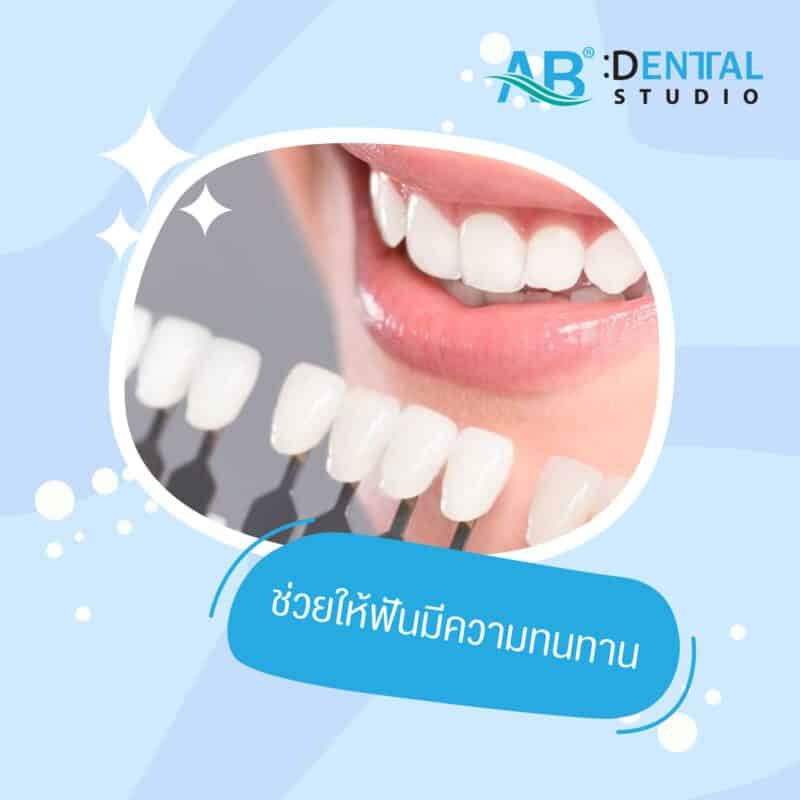 dental veneer, veneer dental, at home dental veneer kit, china dental outsourcing dental veneer, dental veneer cost, dental veneer Patong, dental veneer Thailand, dental veneer design, what is veneer dental, dental veneer perth, veneer dental cost, dental veneer clearwater, fridley dental veneer, dental veneer adhesive, blaine dental veneer, dental veneer prices, dental veneer meaning, veneer dental services, dental veneer dentists gatley, dental veneer process, veneer dental atlanta, dental veneer preparation veneers on teeth, วีเนียร์, dental clinic Phuket, Phuket dental clinic, clinic dental, class one dental clinic, teeth filling, filling teeth, root canal